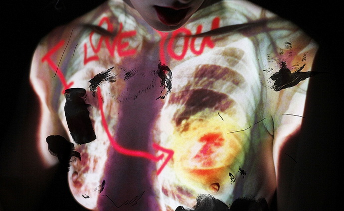 Tumor: karcinogenní romance